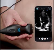 https://crowdfund.afmda.org/app/uploads/2026/02/Butterfly-iQ3-Ultrasound-6000.png